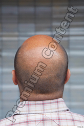 Head Hair Man White Casual Overweight Bald Street photo references